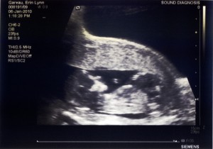 Jan062010-ultrasound